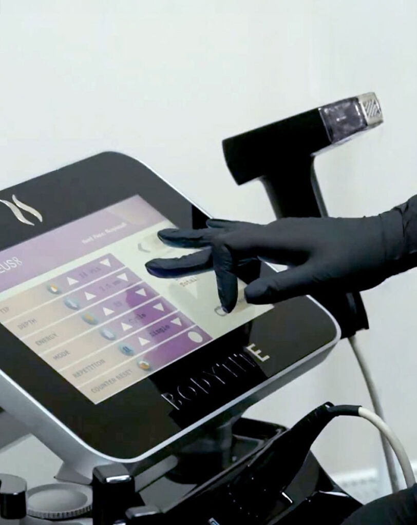 Morpheus8 — Docber Clinic