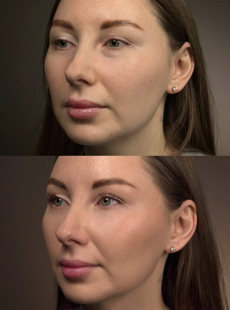 Результат процедури — відгук пацієнта клініки Docber Clinic